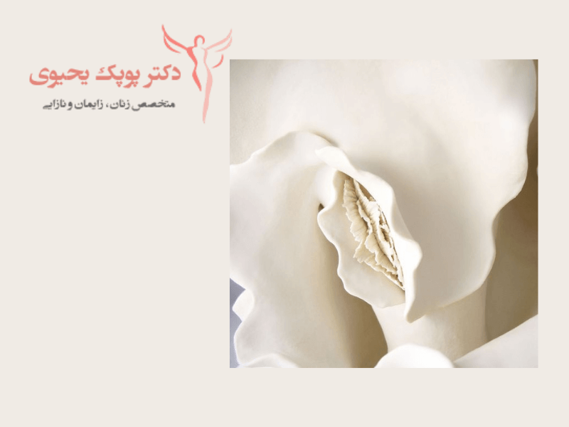 ماندکاری-لابیاپلاستی