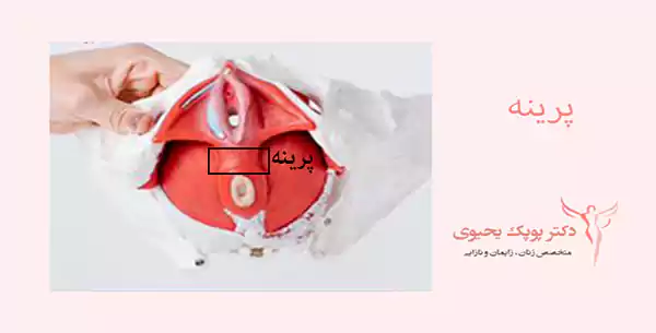 ترمیم-پرینه