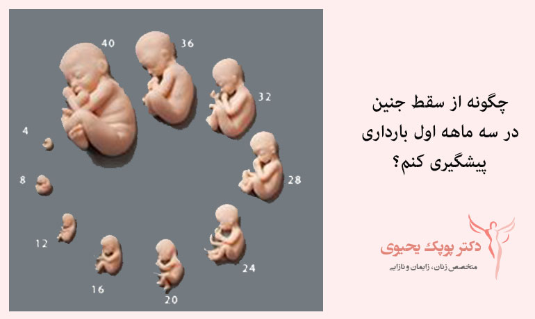 جلوگیری از سقط جنین در سه ماه اول بارداری