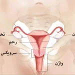 تفاوت واژینوپلاستی و لابیاپلاستی