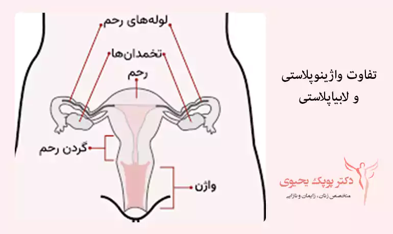 تفاوت واژینوپلاستی و لابیاپلاستی در چیست
