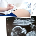 فیبروم رحم در بارداری - دکتر پوپک یحیوی