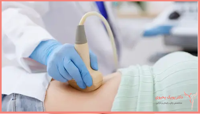 تجربیات بارداری با فیبروم
