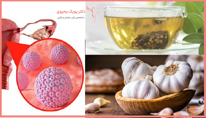 سیر و چای سبز درمان زگیل تناسلی در خانه